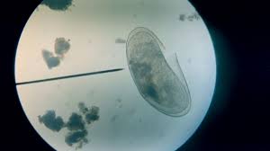 Amateur science at its best! Microscope Pond Water Samples 2016 Youtube