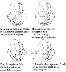 Démarches à effectuer » est mise à jour. Prise En Charge Des Complications De La Grossesse Et De L Accouchement Health Education To Villages