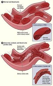 Image result for Red Blood Cell