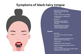 Image result for black hairy tongue symptoms