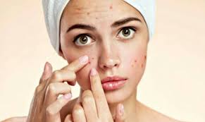 Sebelum mengetahui cara mengobati dan menghilangkan jerawat batu secara alami dengan bahan yang mudah diperoleh, kita harus mencari tahu t. Cara Menghilangkan Jerawat Batu Yang Mudah Dipraktikkan