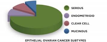 Ovarian Cancer Physiopedia