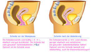 Symptome Beschwerden Blasenzentrum Ch