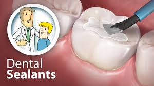 If you only pay the normal application fees of $145, your passport processing it takes from 4 to 6 weeks to get a u.s passport under a standard procedure. Dental Sealants Children S Dental Health Of Lynchburg Lynchburg Virginia