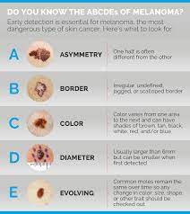 Basal and squamous cell carcinomas are the two most common types of skin cancer. How To Protect Your Skin This Summer Newyork Presbyterian