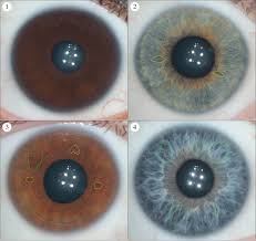 rayid iridology 2