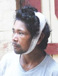 Man accused of glass bottle stabbing in North West nightclub