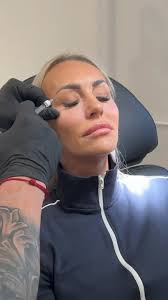 JA TAK TIL SPÆNDSTIGHED? SÅ SE MED 👀 Her viser Vitaranen hvor effektiv den  er, allerede inden patienten er færdigbehandlet 😱Som vi har sagt mange  gange før, så er det en behandling man skal være ...