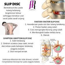 However, like every other news site, we have costs to bear and are urging readers to help share them. Ar Fisioterapi Sakit Belakang Disebabkan Slip Disc Facebook