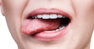 Bright red patches in your mouth that look and feel velvety are called erythroplakia. Avoid Mouth Cancer In 2021 Alexandria Smiles