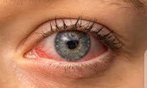 Image result for Ciliary Flush