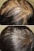 Pink Scalp Thinning Hair
