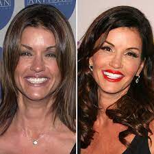 Check spelling or type a new query. Know To The 33 Celebrities With Fake Teeth The Information Was Revealed