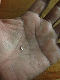 While most people think of them as baby teeth (also known as milk teeth or primary teeth). Apparently Cats Lose Teeth Too Album On Imgur