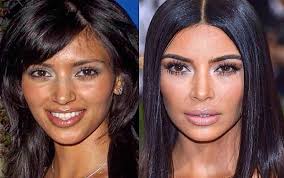 In 2006, kim was 26 and just starting to kim kardashian at a 2007 sons of hollywood party. What Surgeries Do You Think Kim Kardashian Has Had Quora