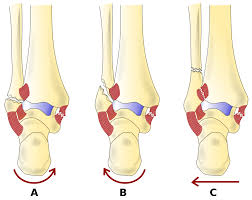 Multiple fractures of lower leg; Danis Weber Classification Wikipedia