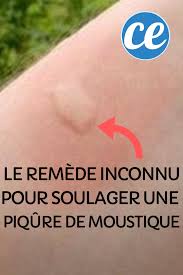 Le persil pour la peau : Le Remede Inconnu Pour Soulager Une Piqure De Moustique Piqure De Moustique Remede Piqure Moustique Moustique
