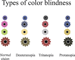More images for types of color blindness » Causes And Treatments For Color Blindnesscheap Contact Lenses Fast Shipping Perfectlensworld