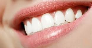 Oral anesthetics desensitize your teeth and gums so you don't feel the discomfort of shifting teeth so acutely. What Are Fastbraces For Teeth