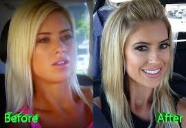 But being a good surgeon isn't just about surgical skill and expertise. Pin On Celebrity Plastic Surgery