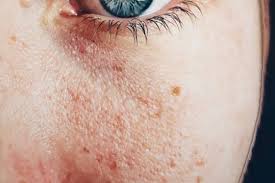 Nahrávejte, sdílejte a stahujte zdarma. 2020è‚ŒãŒæ±šã„å¥³èŠ¸èƒ½äººãƒ©ãƒ³ã‚­ãƒ³ã‚° 1ä½ã®æ±šè‚Œã¯èª° æ¡è°·ç¾ŽçŽ² å®‡å®™ã‚'å–ã‚Šå·»ãè¬Ž èŠ¸èƒ½ ã‚¹ãƒãƒ¼ãƒ„ ãƒ‹ãƒ¥ãƒ¼ã‚¹ã®ãƒã‚¿æƒ…å ±