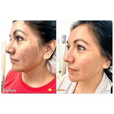 Luminous Glow Skin & Laser, 19669 W Avalon Dr, Buckeye, AZ 85396, US