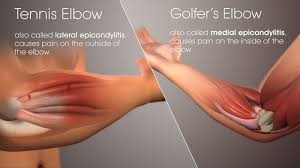 Strength training inadvertently increases tendon strength, but by targeting tendons specifically, you can create a stronger chain without weaknesses to smash personal bests and plateaus. The 10 Best Golfer S Elbow Brace Treatment Plan