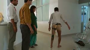 For patients without health insurance, a prosthetic leg typically costs less than $10,000 for a basic prosthetic leg up to $70,000 or more for a more advanced computerized prosthetic leg controlled by muscle movements. What Do Prosthetics Cost