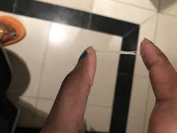 Jun 17, 2021 · ovulation spotting usually occurs before, after or during ovulation, which is anytime between 11 and 21 days after the first day of your last period. Stretchy Clear Cm After Ovulation Sensitive Photo Attached Babycenter