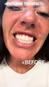 On the road again ⛰