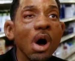 An epinephrine injector can treat anaphylaxis is when you get severe allergic reactions. Anaphylaxis Shock Or Anaphylactic Shock Or Anaphylactic Reactions Are Serious Allergic Reactions That Could B Anaphylaxis Shock Funny Cute Memes Reactions Meme