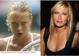 Résultat de recherche d'images pour "maria bartiromo implants"