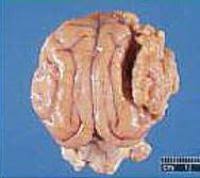 For example, if your dog has a mass, note how long it has been present and whether it has grown in size since you noticed it. Brain Tumor Animal Cancer And Imaging Center