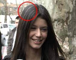 Saclarin Beyazlamasini Onlemek Icin Ipuclari Saglik Haberleri
