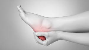 Haglundexostose Physiozentrum