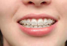 Nguyên nhân, triệu chứng và cách chữa bệnh rối loạn khớp thái dương hàm