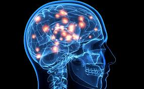 Risk of cerebral angiography in patients with subarachnoid hemorrhage, cerebral aneurysm, and arteriovenous malformation: Que Es La Muerte Cerebral