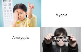 Image result for Amblyopia