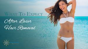 Waxing and plucking both remove the hair shaft, and since the laser uses hair shafts to find the target follicles, removing these hairs makes it impossible for the laser to do its job. What To Expect After Laser Hair Removal Treatments Indy Laser