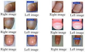 Image result for Digital Clubbing