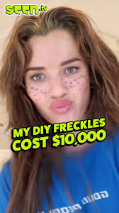 I got my freckles