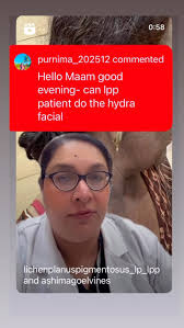 #HydrafacialMD treatment in #LPP , (Dr Ashima Goel MD Dermatologist, ,  Dermatologist in Chandigarh,, PARISA skin clinic,, Lichen Planus  Pigmentosus)