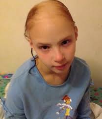 Girl left BALD after 'shampoo caused her long red hair to fall out in  chunks'