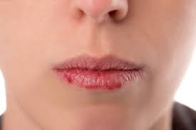 Tubuh saya sentiasa panas apabila 12 pagi pada waktu pagi. Apakah Punca Bibir Kering Dan Berdarah Eyqa Hasnan S Blog