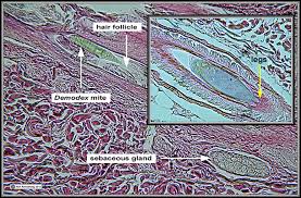 Labelled pictures of human skin : Mites