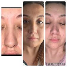 Dog's rapid recovery from swelling