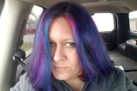 Fundraiser by Jessica Heiser : Life changing brain surgery needed