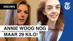 Era arrivata a pesare solo 29Kg per colpa dell'anoressia, ma una barretta  di cioccolato l'ha aiutata a guarire