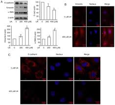 The mesothelium is a slowly renewing tissue. Ua Promotes Epithelial Mesenchymal Transition In Peritoneal Mesothelial Cells