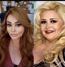 RECUERDAS A SHEYLA DE LA ESCUELITA?? El impactante cambio de Sheyla Tadeo:  así luce tras perder 58 kilos y donar su piel a niños quemados. La actriz y  cantante compartió por primera
